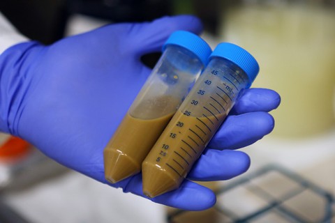 Fecal Transplants