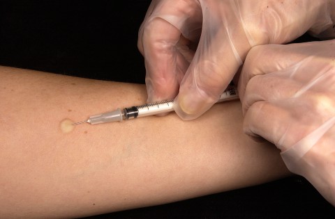 tb test