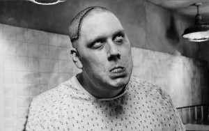 Lobotomies Trepanation