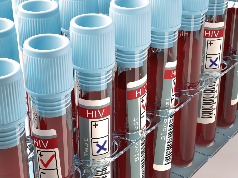 HIV Drug