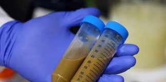 Fecal Transplants