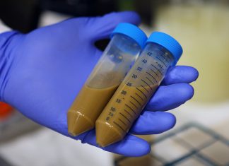 Fecal Transplants