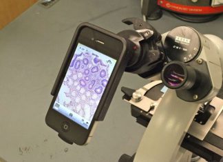smartphone microscope