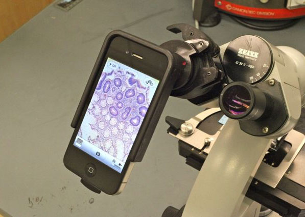 smartphone microscope