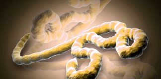 ebola virus