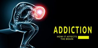 Addiction